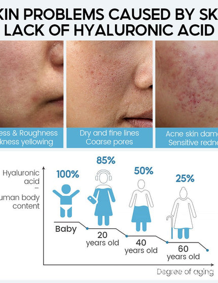 Hyaluronic Acid Face Serum Anti-Aging Shrink Pore Whitening Moisturizing Face Cream Dry Skin Care